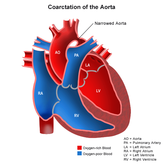 Cardiology Patient Eduction Aicd